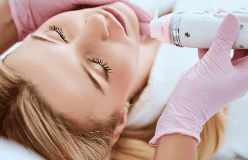 Viora laser technology treating unwanted hair on face and body