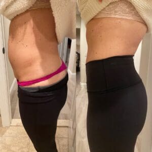 Emsculpt NEO body contouring treatment for first time clients Newton NJ