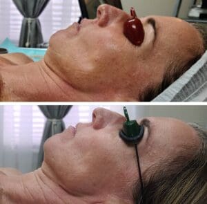 Laser Hair Removal | Bella MediSpa & Salon